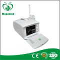 MY-A001A Laptop full digital portable ultrasound scanner mini ultrasound machine